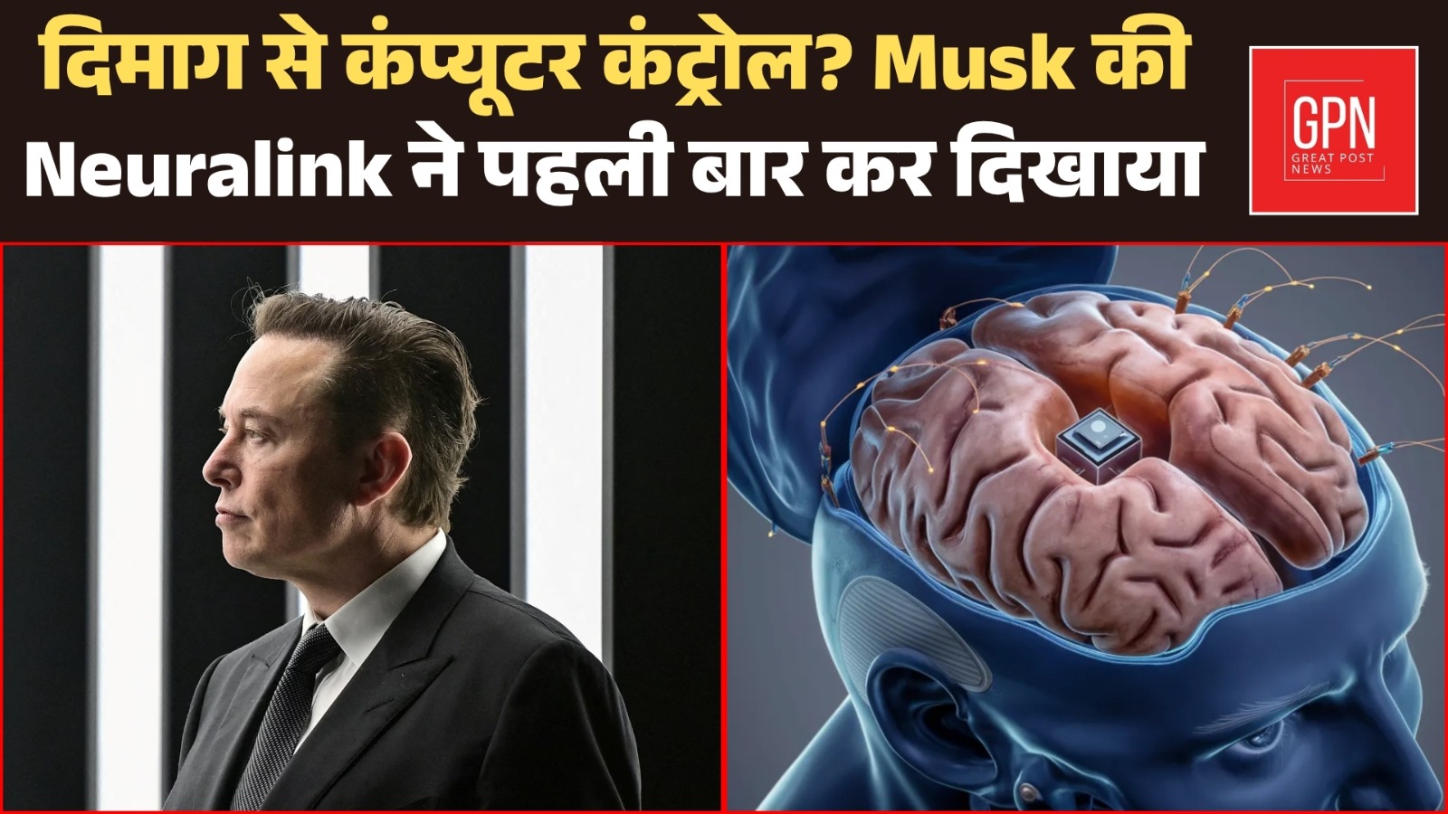 Neuralink Just Did What Was Once Only Seen in Sci-Fi Movies || Great Post News